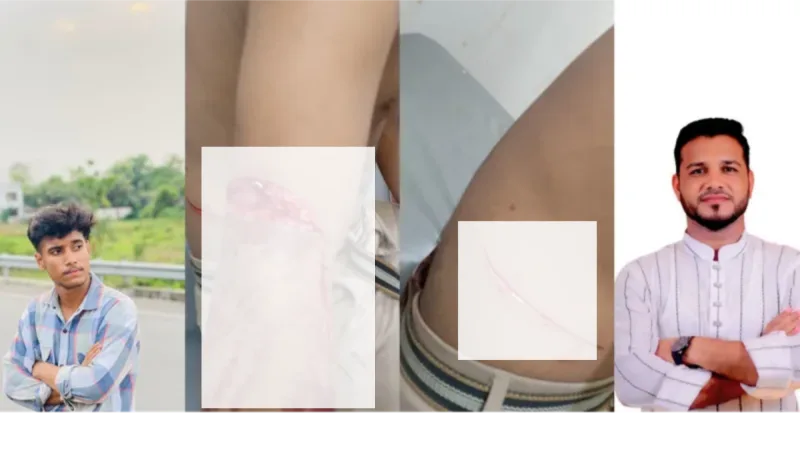 আনোয়ারায় ফুটবল মাঠে কিশোরদের ওপর ছাত্রদলের হামলা, ধারালো অস্ত্রের আঘাতে আহত ১