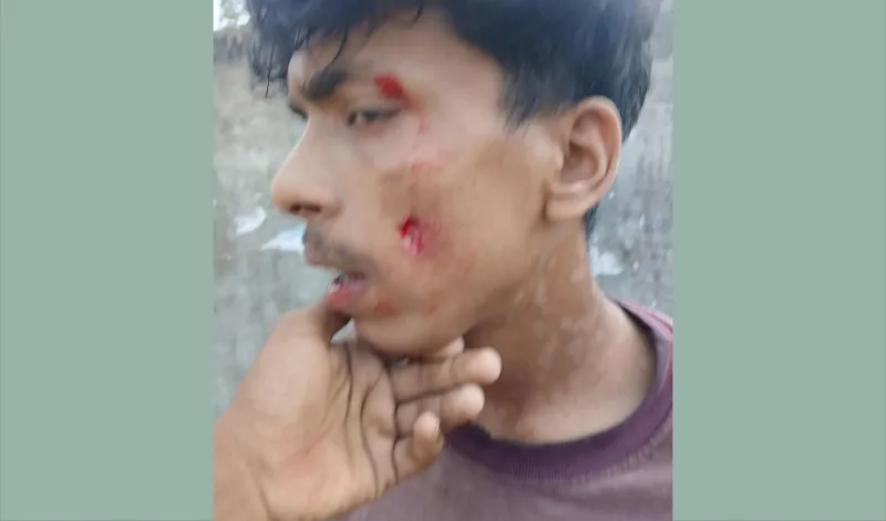 আনোয়ারায় মাদক বিক্রির প্রতিবাদ করায় যুবককে ছুরিকাঘাত!