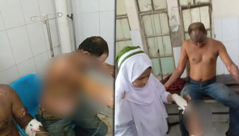 বোয়ালখালীতে লবণ কারখানায় বিস্ফোরণ ও আগুন, ১১ শ্রমিক দগ্ধ