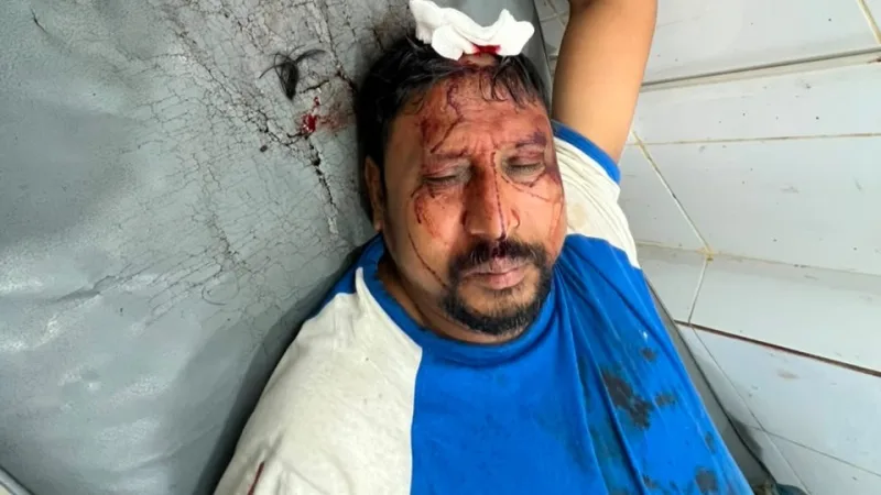 আনোয়ারায় আর্থিক লেনদেনের বিরোধে যুবদল কর্মীর ওপর হামলার অভিযোগ